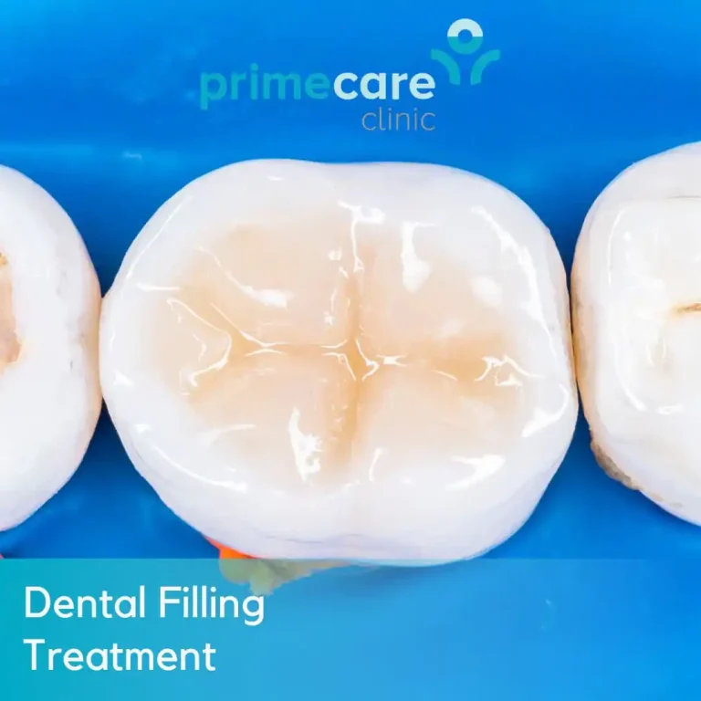 Dental Filling Treatment