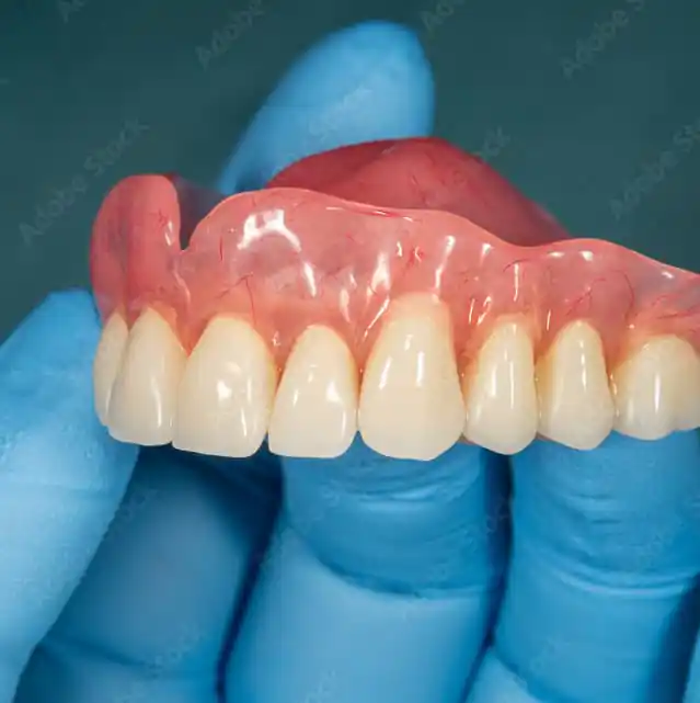 full denture